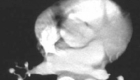 Biomarc - Computerized Tomography - CT